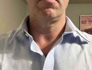 Tailor Store Shirts Collar Defect
